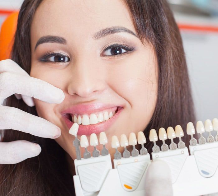 Dental Implantologie tipos de dientes
